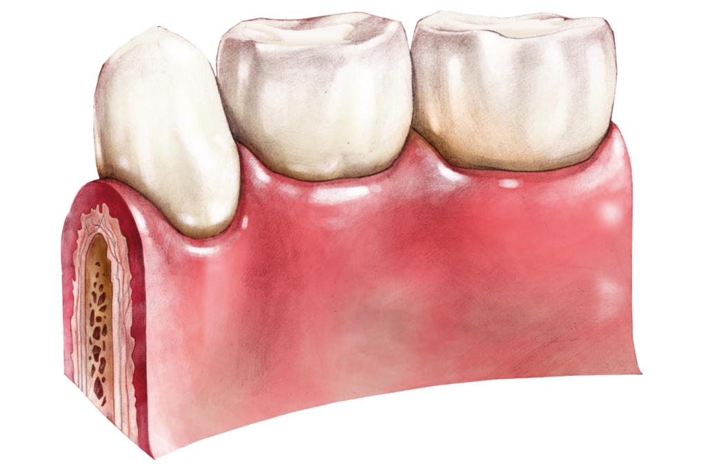 Sigillatura dei denti decidui sani