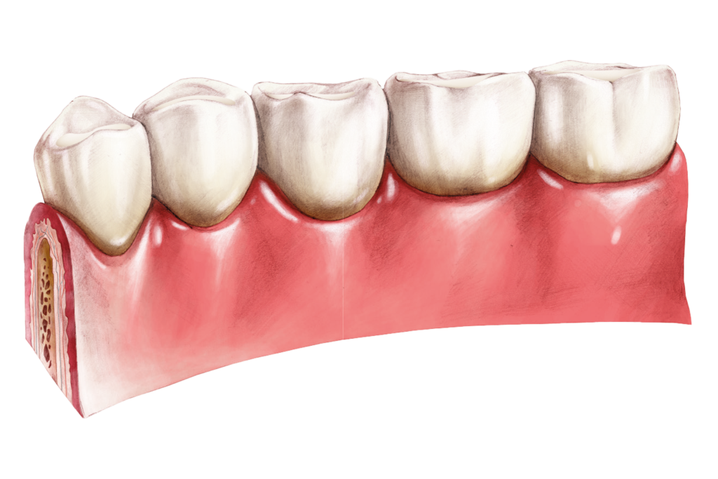 Sigillatura dei denti permanenti sani